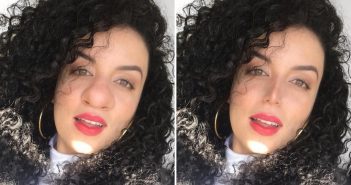 Cirurgia plástica para sair bem nas selfies